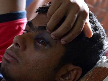 Under PDP-BJP rule, Kashmir saw 74 percent more people certified 'disabled'; pellet guns behind rise in numbers