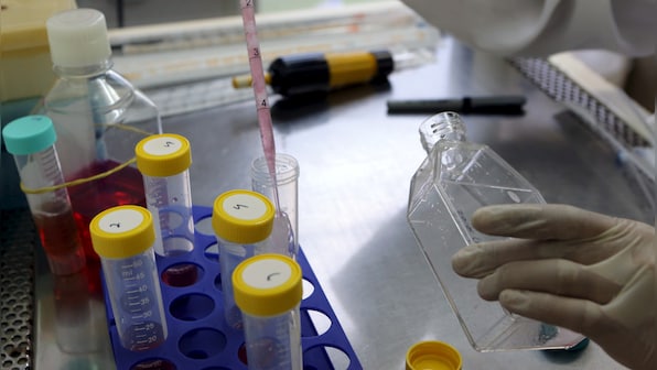A new protein that could treat sepsis identified by IIT Roorkee scientists