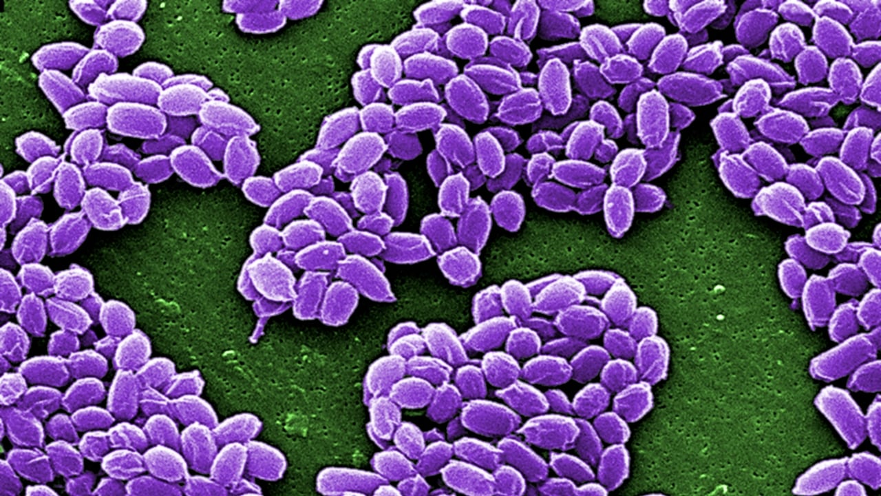 Spores from the Sterne strain of anthrax bacteria (Bacillus anthracis) are pictured in this handout. Reuters