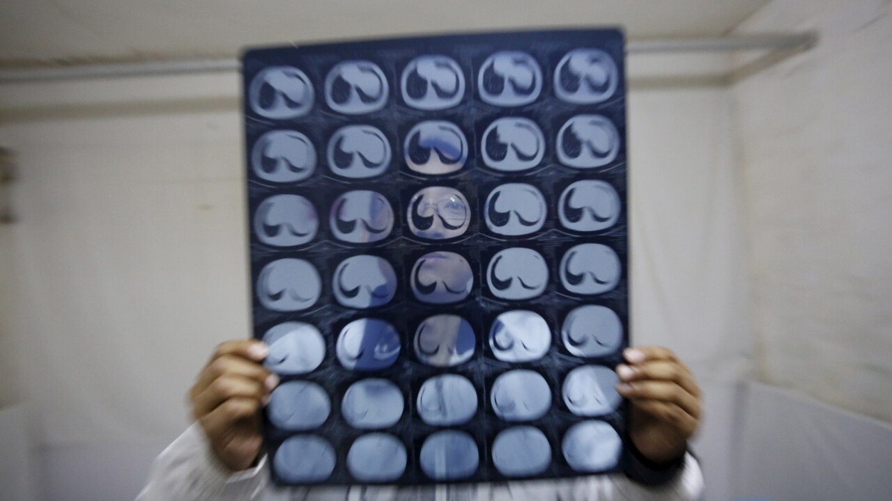 Representational image. Reuters