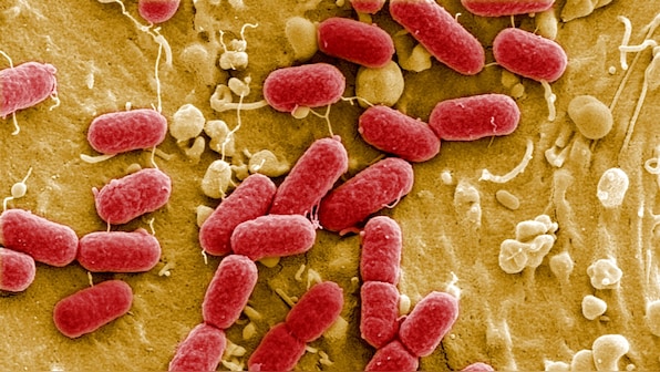 Proteins used by Encephalitis-causing virus to enter brain cells identified