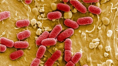 Scientists explain strange behaviour of gut bacteria resistant to TB drugs
