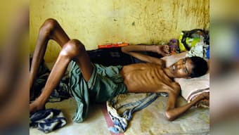 Battle against drug-resistant TB: Like South Africa, India needs to allow access to 'game-changing' bedaquiline, says researcher