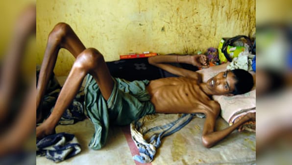 Battle against drug-resistant TB: Like South Africa, India needs to allow access to 'game-changing' bedaquiline, says researcher