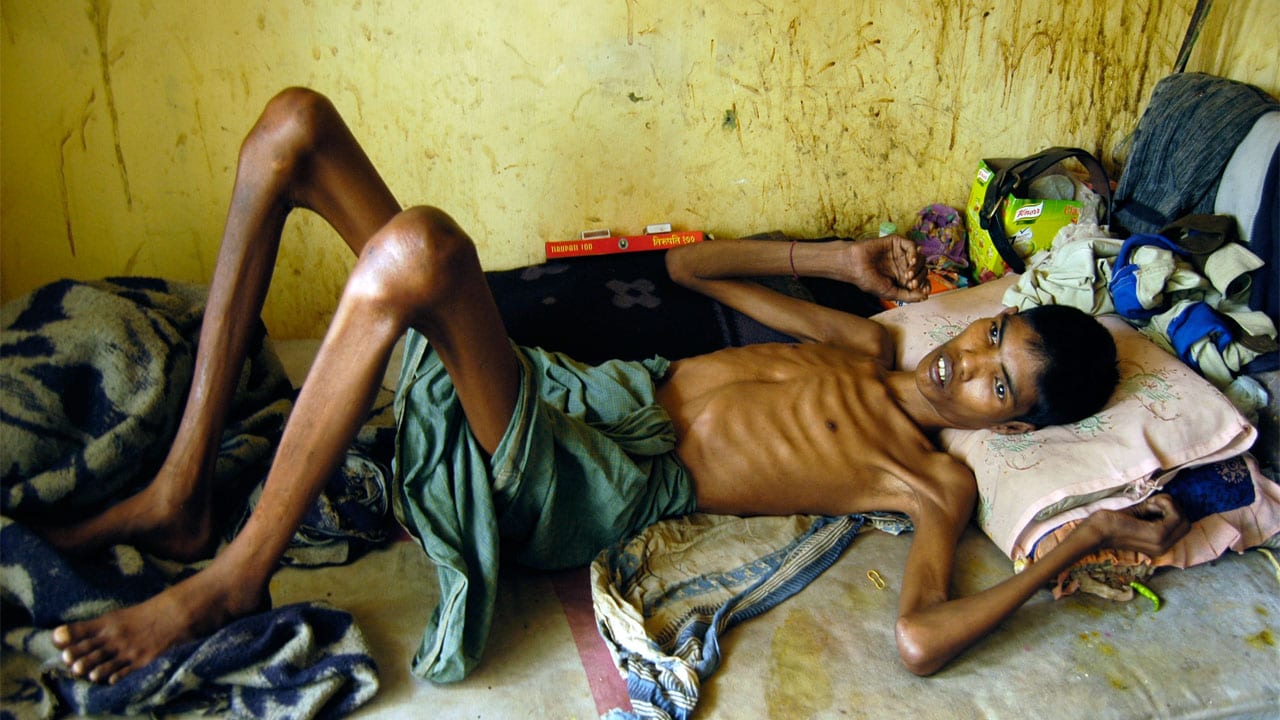 A tuberculosis victim in _. Reuters