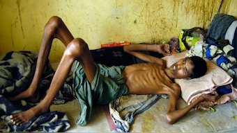 Indo-US trade war is a new challenge to India’s TB elimination program