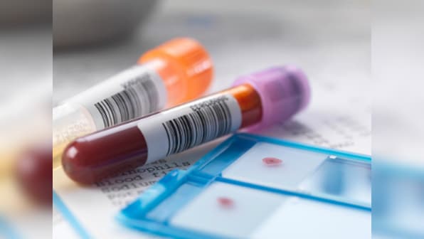 Houston hospital tries blood transfusion therapy to cure coronavirus patients: How it works and what doctors are saying