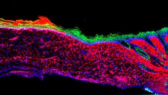 Cells in a wound reprogrammed into skin cells in a revolutionary new technique