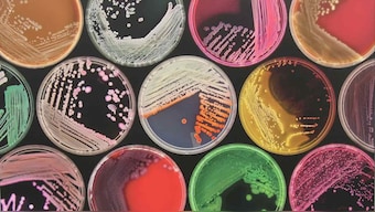Breakthrough test for infections looks for all known harmful bacteria at once