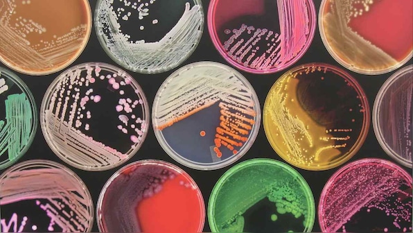 Breakthrough test for infections looks for all known harmful bacteria at once