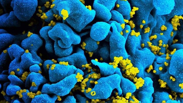 Experimental antibody drugs like Regeneron's don't cure COVID-19, but seem promising treatment options
