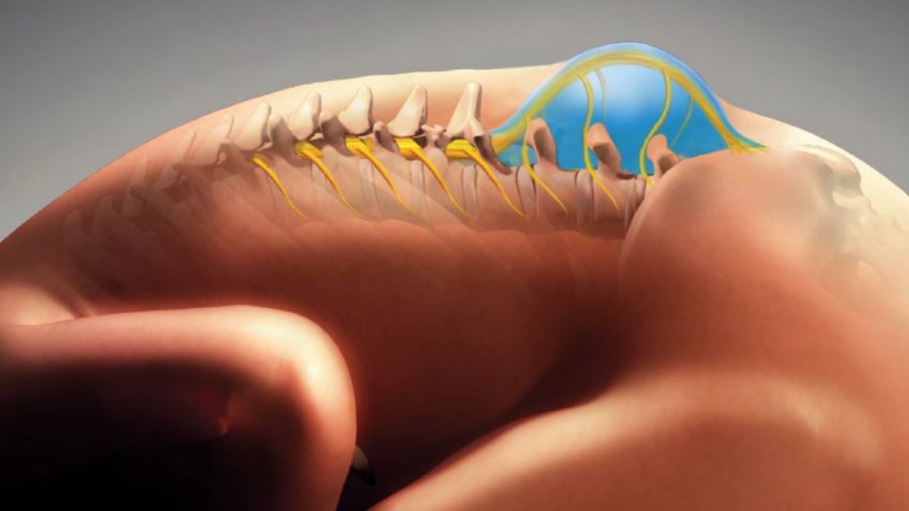 Women can keep spine healthy after 35: Here's how Women can keep spine healthy after 35: Here's how