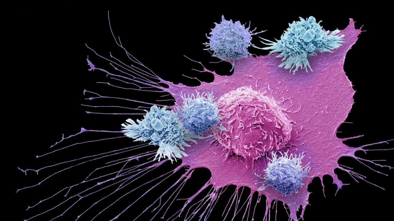 A false-coloured image of T-cells around a breast cancer cell under a scanning electron microscope (SEM). Image courtesy: Gschmeissner/Science