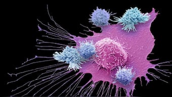 New immunotherapy treatment shows promising results for stubborn breast cancers