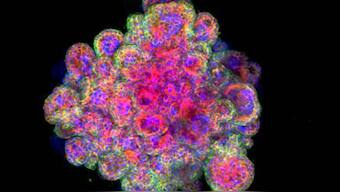 Scientists create mini human placenta organoids to study reproductive disorders