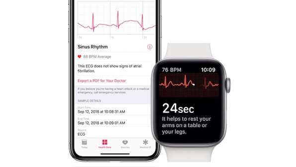 Apple Series 4 watchOS 5.1.2 update may not bring ECG support to India for months