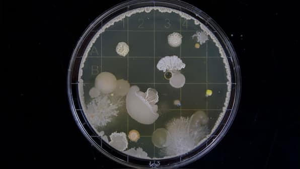 Over 6,000 antibiotic resistance genes found in bacteria that inhabit the gut