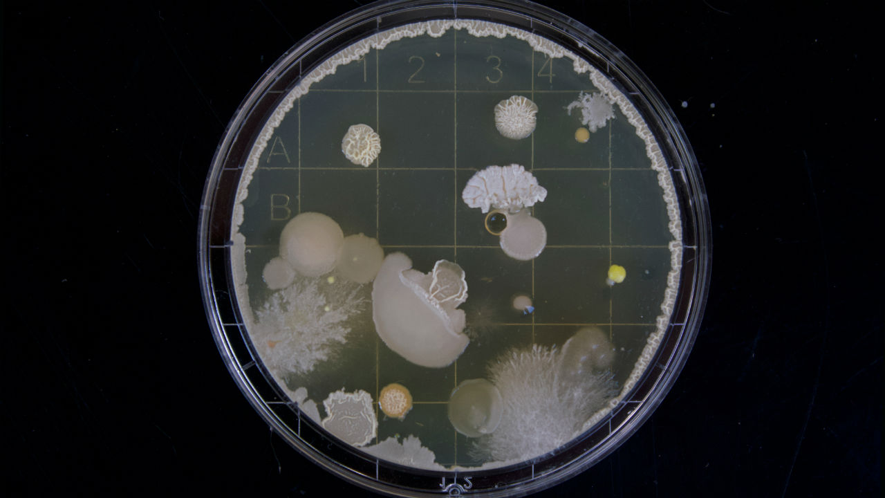 Salmonella found to be resistant to antibiotics used to treat foodborne diseases Salmonella found to be resistant to antibiotics used to treat foodborne diseases