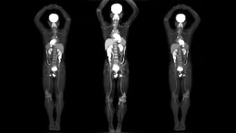 First 3D images produced by the world's first full-body scanning technology