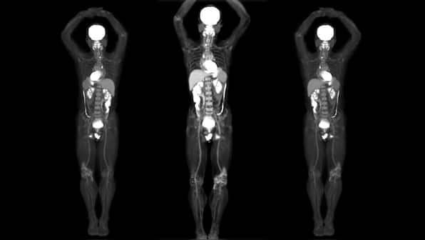 First 3D images produced by the world's first full-body scanning technology