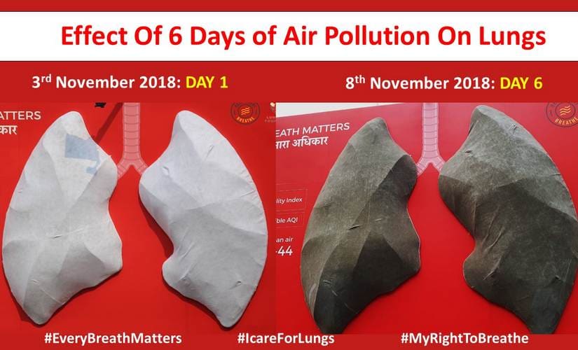 Effect of air pollution on lungs in six days. Rashme Sehgal