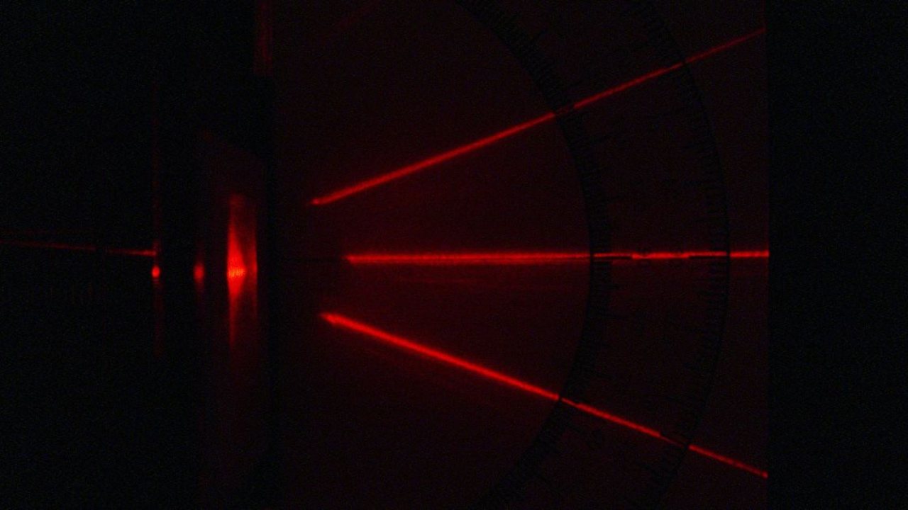 Non-invasive method uses laser flashes to gauge how well burn wounds are healing Non-invasive method uses laser flashes to gauge how well burn wounds are healing