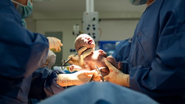 World's first baby born to a mother after womb transplant from a dead uterus donor