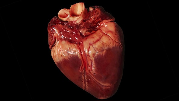 Indigenously designed and manufactured artificial aortic valve launched in India