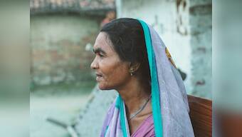 Kala Azar in India: Patients detected with PKDL, skin manifestation of the disease, say treatment is unbearable