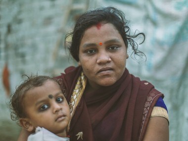Kala Azar and its subsequent skin manifestation, PKDL, shattered these women's lives, left them with uncertainty, stigma