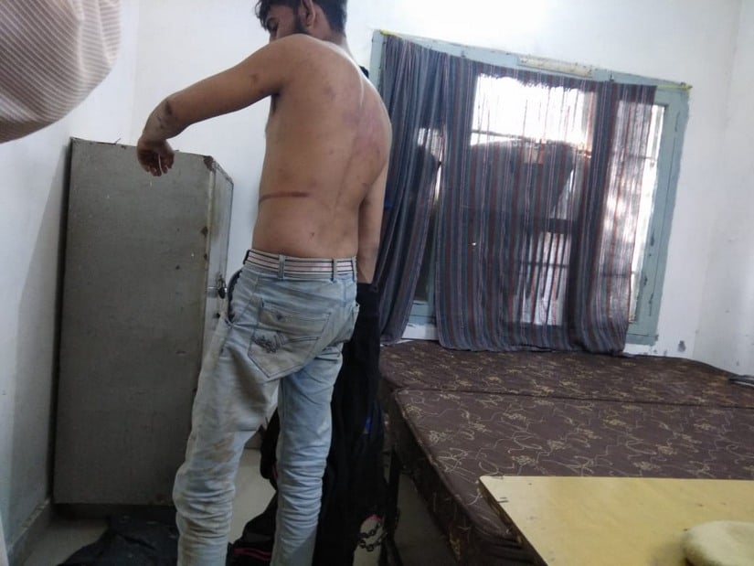 Naushad Muhammed was brutally beaten by cow protection activists. Image Courtesy: Sat Singh