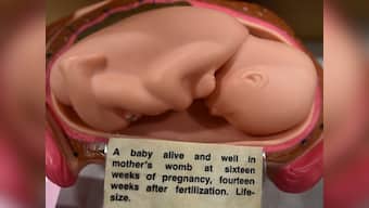Calcutta High Court rejects woman's plea to abort 26-week-old foetus with Down Syndrome, says 'no harm to mother's life'