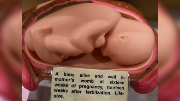 Calcutta High Court rejects woman's plea to abort 26-week-old foetus with Down Syndrome, says 'no harm to mother's life'
