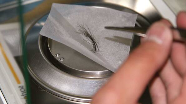 Vitamin D levels now measureable from strands of human hair instead of blood