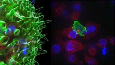 Decoy bacteria and tiny 'nanobodies' paired up to fight cancer in new technique