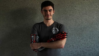 Teen builds for himself a robotic, colourful prosthetic arm using Lego pieces