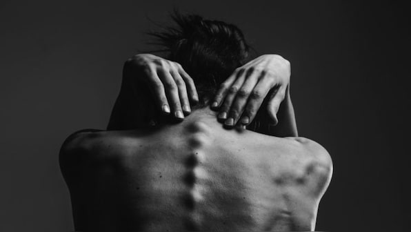 World Health Day 2019: Common myths & misunderstandings about eating disorders