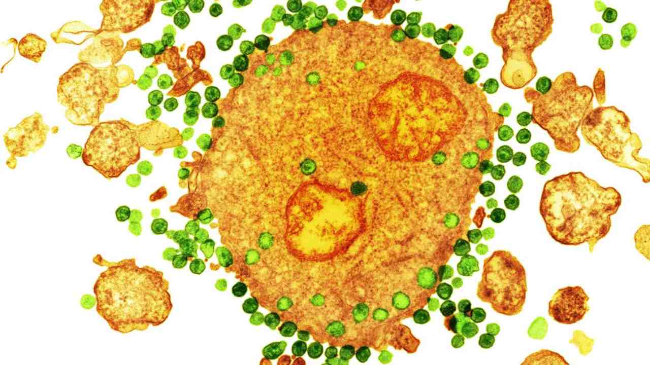 HIV virus, in green, attaching to a white blood cell, in orange, as seen under a colored transmission electron microscope. Image credit: NIBSC