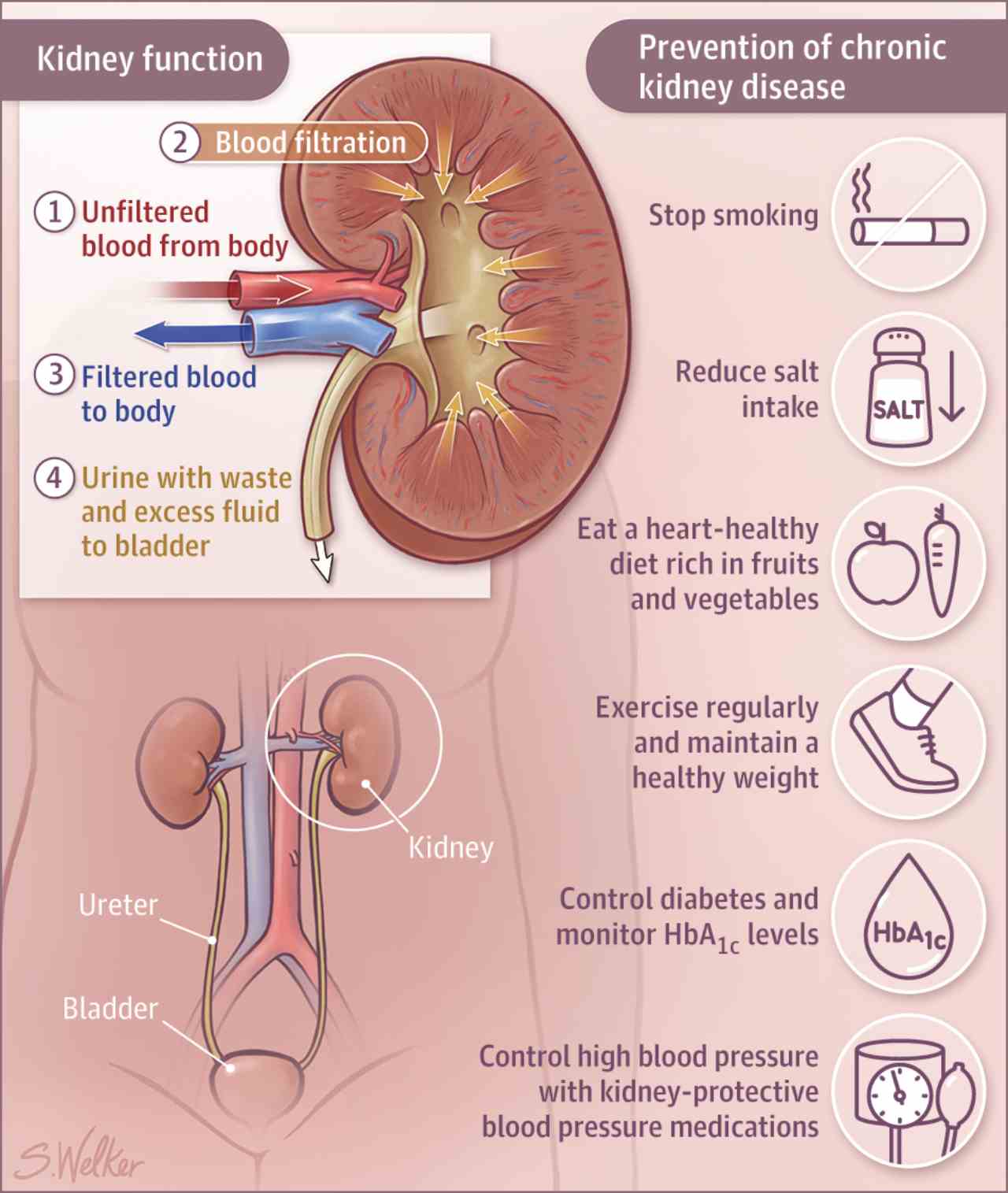 What Are The Causes Of Kidney Disease