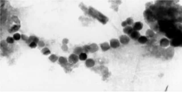 Chains of magnetosomes from a sockeye salmon. Image credit: Mann, Sparks, Walker & Kirschvink (1988)