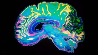 Researchers map free will, choice seconds before making decisions in brain scans