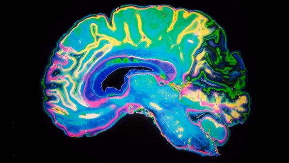 Researchers map free will, choice seconds before making decisions in brain scans