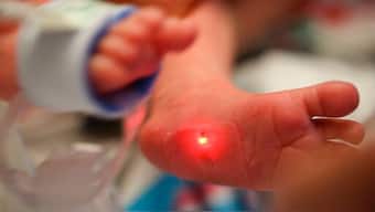 New wireless sensors monitor sick babies, lets parents cuddle them at the same time
