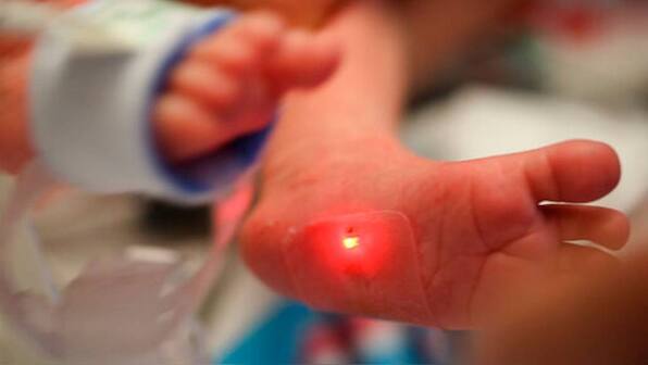New wireless sensors monitor sick babies, lets parents cuddle them at the same time