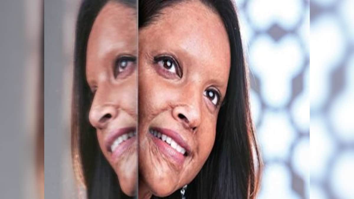 Taking cue from Deepika Padukone film Chapaak, Uttarakhand government proposes pension scheme for acid attack survivors