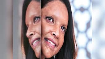 Chhapaak: As the 'face' of an acid attack survivor's story, Deepika Padukone rises above conformist notions of beauty