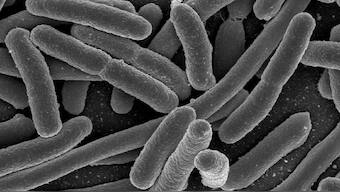 Anxiety can be controlled using probiotics to keep the gut bacteria under control