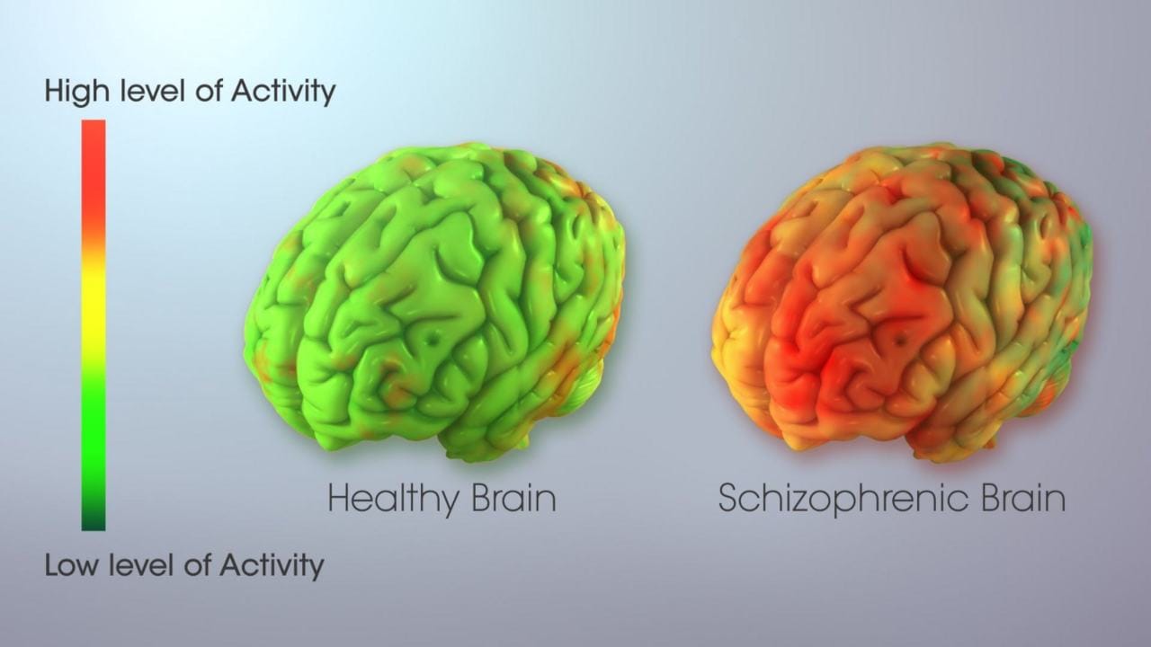 dissociative-identity-disorder-vs-schizophrenia-the-misconception