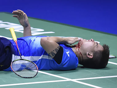 Sudirman Cup 2019: Malaysia's Teo Ee Yi injured after doubles partner Ong Yew Sin smashes his face during QF clash Sudirman Cup 2019: Malaysia's Teo Ee Yi injured after doubles partner Ong Yew Sin smashes his face during QF clash