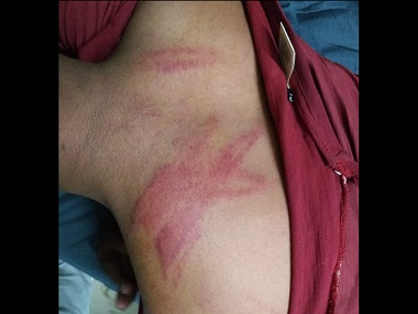 Muslim man in MP abused, beaten, paraded for asking for box of mobile phone, claims religion-based hate; police term it 'scuffle' Muslim man in MP abused, beaten, paraded for asking for box of mobile phone, claims religion-based hate; police term it 'scuffle'